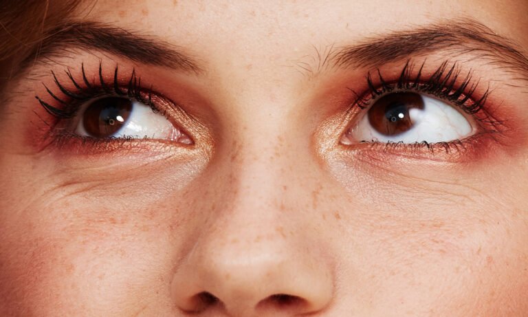 This Common Vitamin May Lower Glaucoma Risk In High-Risk Adults